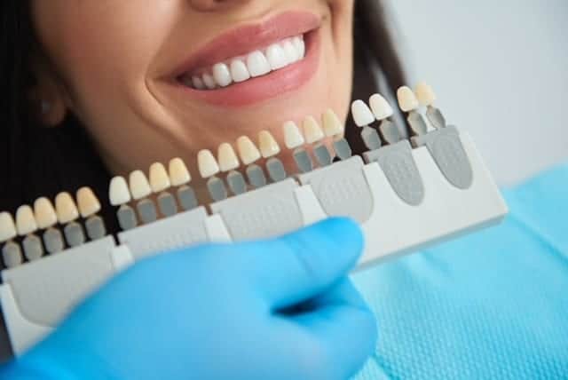 Close-up of a patient’s smile with dental veneers being matched by a dentist.
